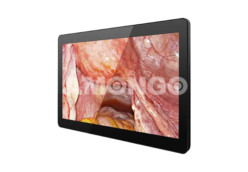 Medical Display