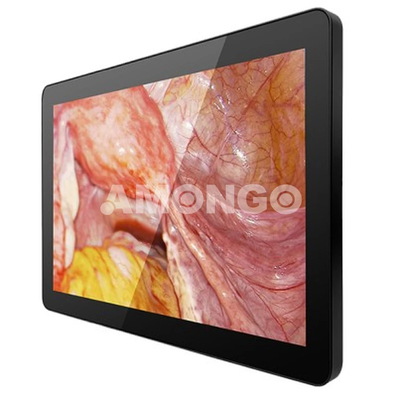 AMG 15OPTD01G1 Medical Display manufacturer